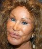 rhinoplasty.jpg