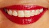 orthodontics.jpg