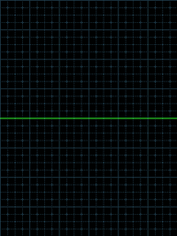 ekgline_vvazzhcl.gif