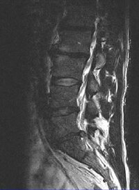 MRI1.jpg