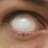 blind eye
